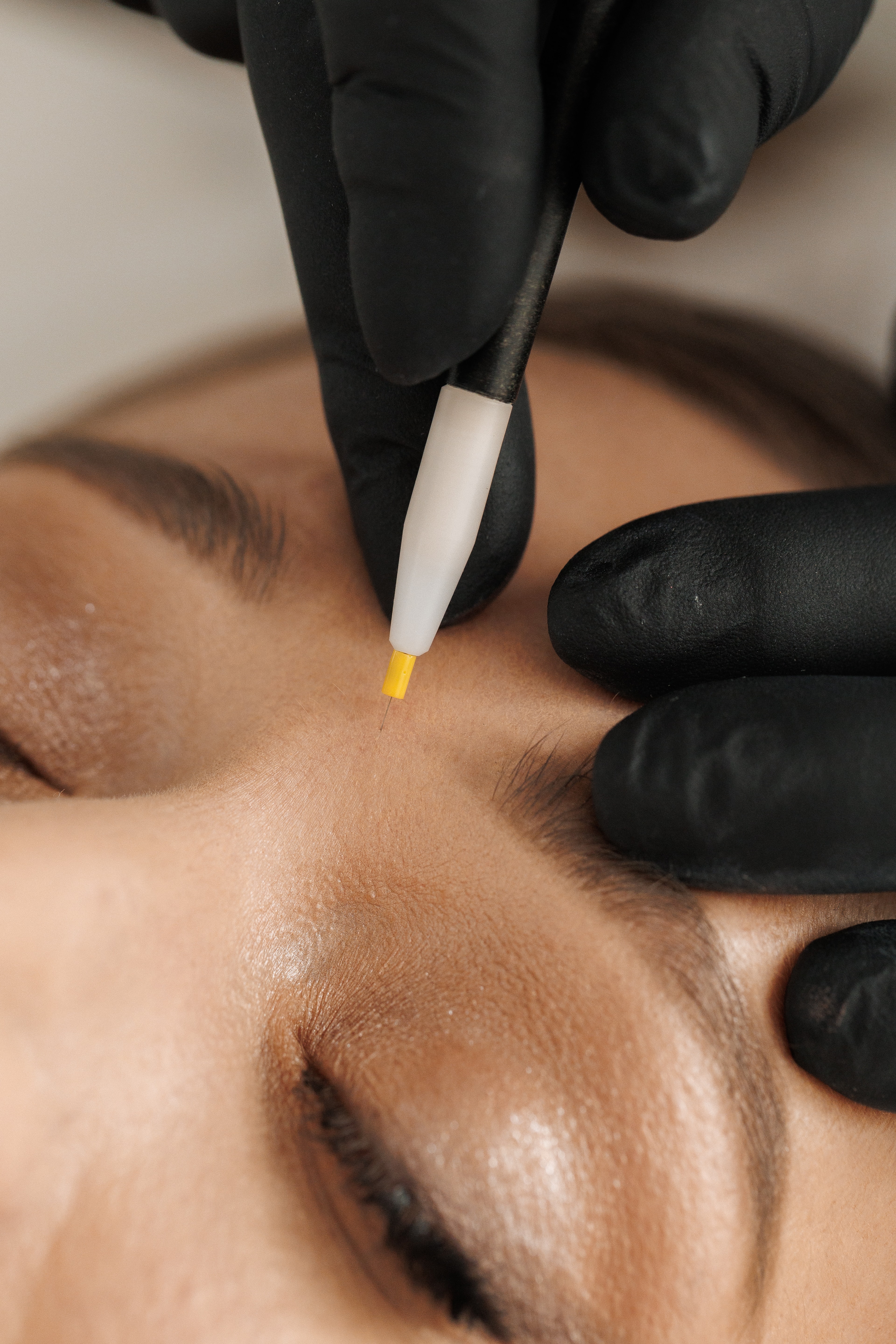 Electroepilare